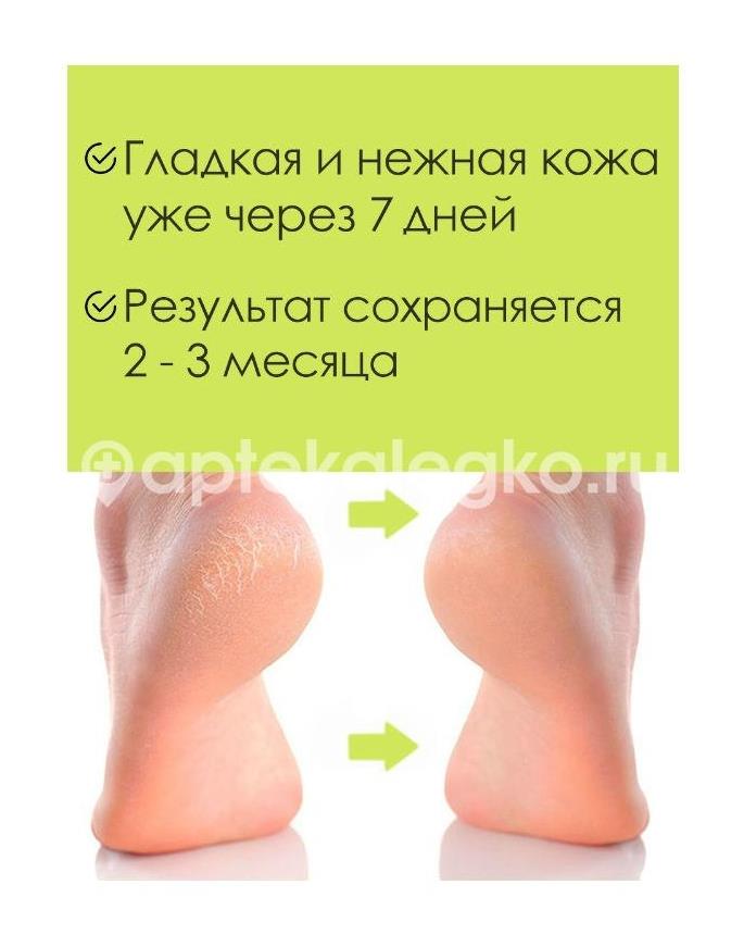 Скинлайт - 275 маска - носки для ног отшел. р.35 - 40 [skinlite] - 2